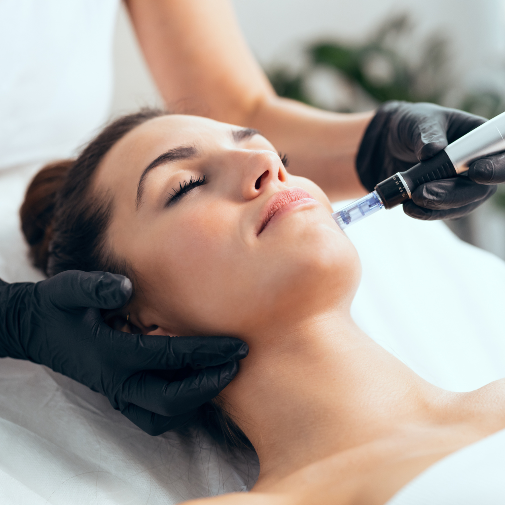 Microneedling with Plasma